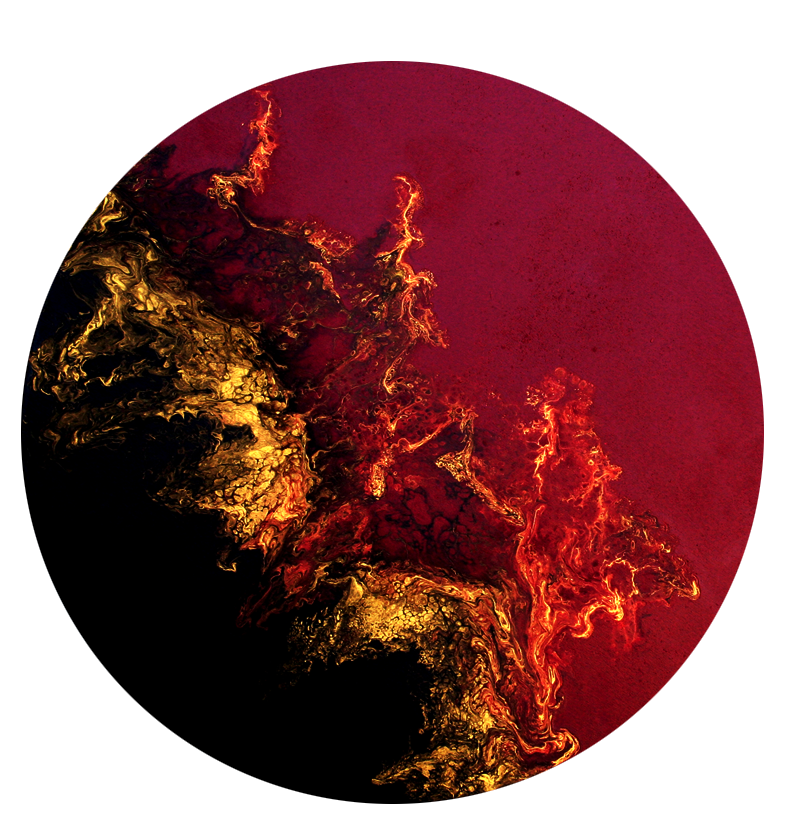 Sunburn